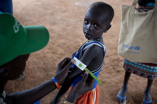 En esta foto del 20 de octubre de 2016 y difundida por UNICEF, una persona mide el brazo a un niño para evaluar si padece desnutrición, en Kuach, Sudán del Sur. Más de 100.000 personas en dos condados de Sudán del Sur sufren hambruna y se teme que la situación pueda extenderse a un millón de sudaneses, dijeron el gobierno y tres agencias de Naciones Unidas, el lunes 20 de febrero de 2017. (Kate Holt/UNICEF via AP)